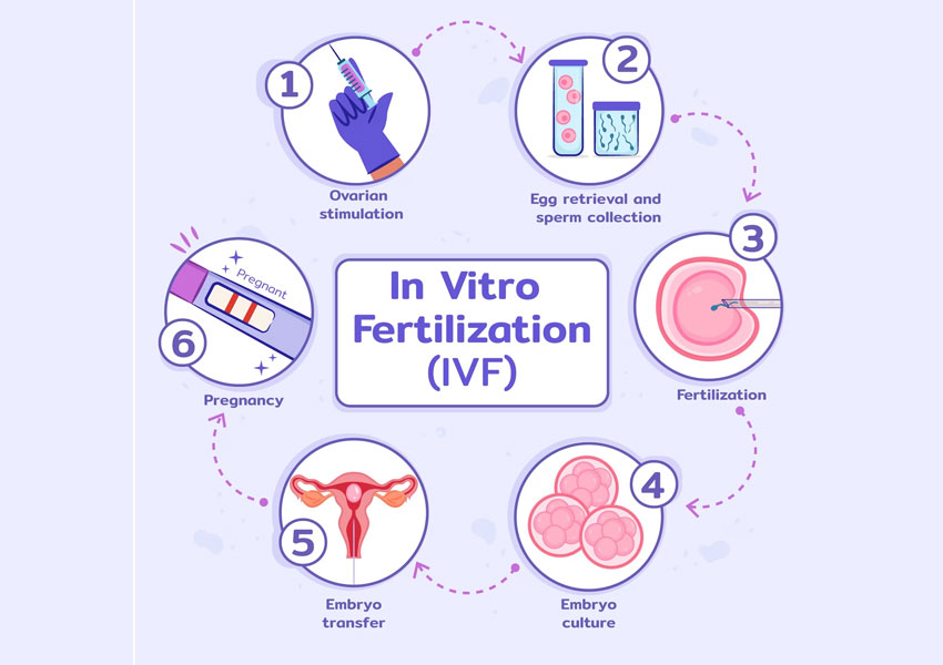 steps of ivf treatment