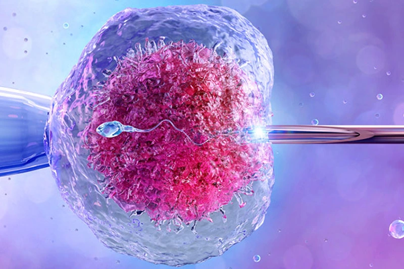 Cyprus IVF Treatment