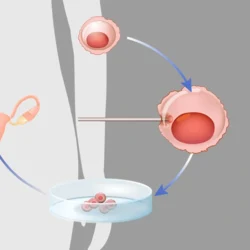 Embryo Donation Cyprus